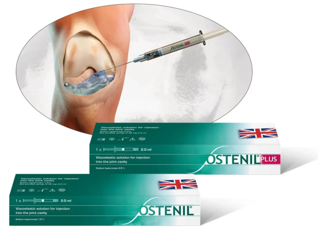 Knee injection with UK Ostenil Packs